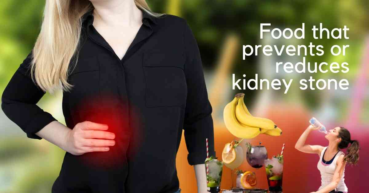 Kidney stone